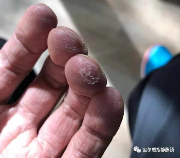 璽爾盾指靜脈鎖告訴您給老年人購買智能鎖需要注意什么 璽爾盾指靜脈鎖告訴您給老年人購買智能鎖需要注意什么